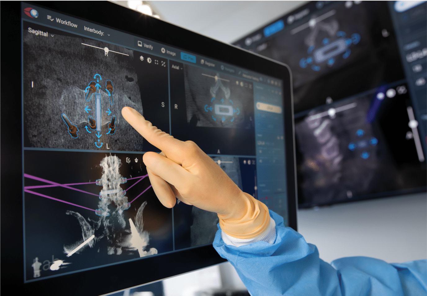 Excelsius GPS Anterior Hip